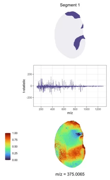 T-statistics and spatial distribution map of regional characteristic metabolites.